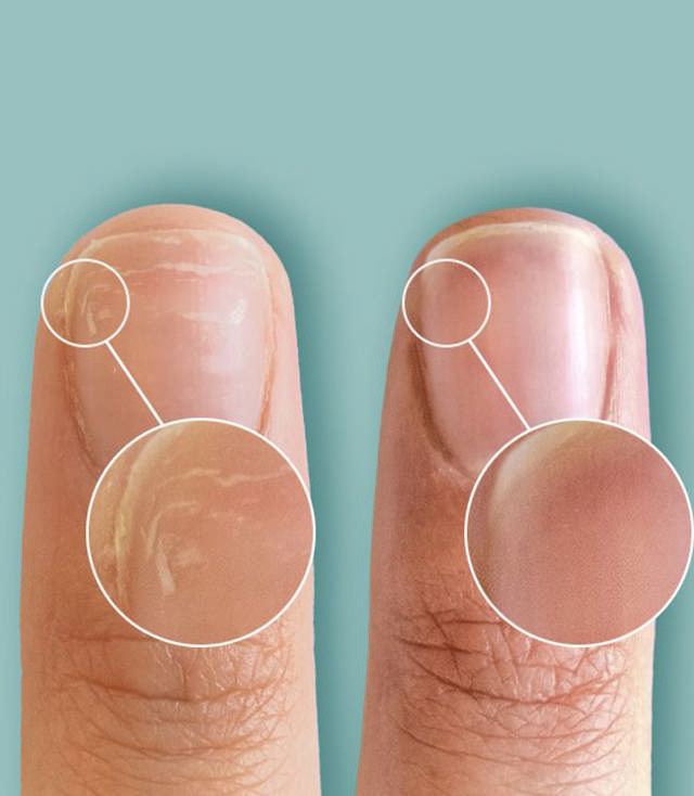 CND RescueRXx Daily Keratin Treatment, 3,7 ml.